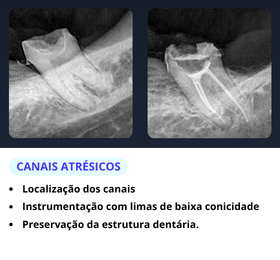 Caso Clínico 1